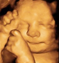 Ecografia de l'embaràs a Figueres - ginecoleg